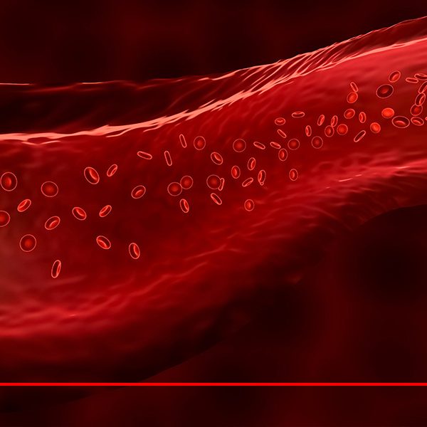 10-approaches-to-treat-anemia