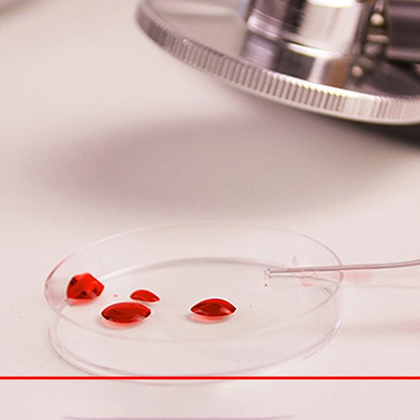 What-is-iron-deficiency-anemia-and-what-is-Reolin