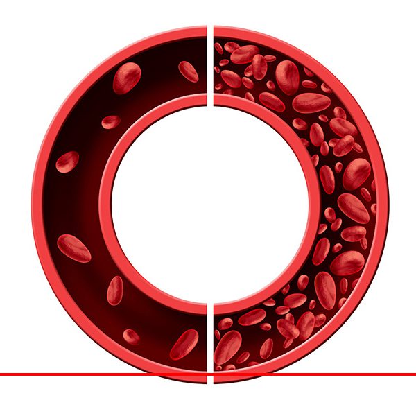 Why-is-Reol-more-effective-than-other-iron-supplements reol best iron supplements