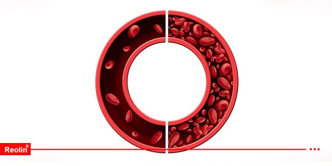 reol best iron supplements